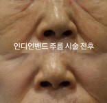 삼성비앤에스의원 강남