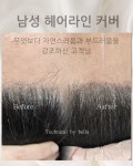 채우다아카데미 탈모커버&생장술&숱채움&눈썹커버&원형탈모