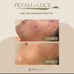 힐스킨7에스테틱