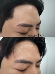 퓨어리티