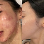 온스킨라운지 안양범계점