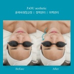 제이스오유 에스테틱 대구피부관리