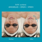 제이스오유 에스테틱 대구피부관리