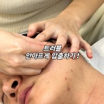 제이스오유 에스테틱 대구피부관리