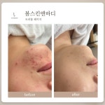 최봄스킨바디 | 봄스킨앤바디