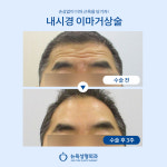 뉴욕성형외과