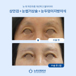 뉴욕성형외과의원