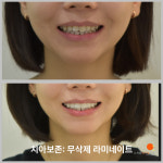 오앤오치과의원