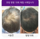 큐사랑 수지상현점