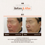 로아르피부과의원