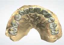 월드베스트디지털치과기공소