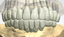 월드베스트디지털치과기공소