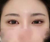 어나더유