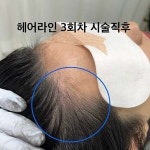 모마인드 스칼프 디자인센터