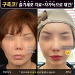 프레쉬이비인후과의원