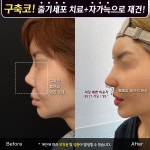 프레쉬이비인후과의원