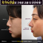 프레쉬이비인후과의원