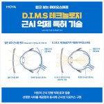 밝은안경