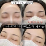 아미브로우