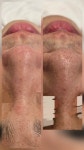 고원장의모공세척테라피 시흥은계점