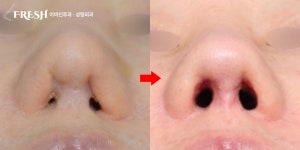 프레쉬이비인후과의원