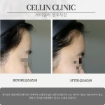 셀린의원 수원망포점