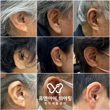 광고 이미지