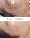 재영 뷰티 에스테틱 (Jaeyeong Beauty Aesthetic) | 재영뷰티에스테틱