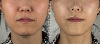 꽃다비스킨케어