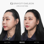 그레이시티 대전직영점