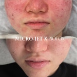 꽃다비스킨케어