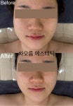 차오름