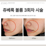 제로피부과의원
