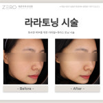 제로피부과의원