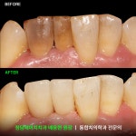 청담에이치치과의원 포항양덕점