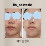 진에스테틱