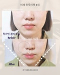 비채