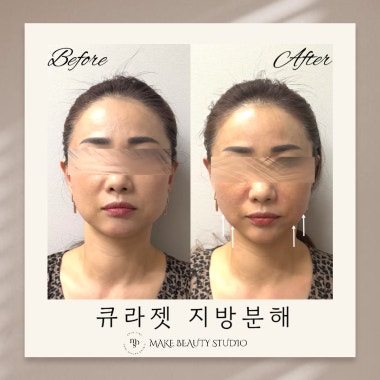 광고 이미지