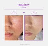 블레싱스킨케어