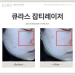 제로피부과의원