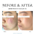 보네르슈가 왁싱&피부 인천연수점