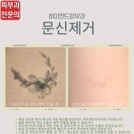 하이엔드피부과의원