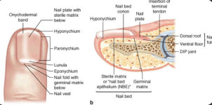 봉숭아손톱 레푸스 압구정점