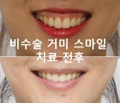 센트럴치과의원 강남점