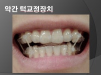 예스부부치과의원