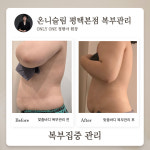 온니슬림림프관리