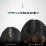 생명나무두피프렌즈 | 두피움SMP