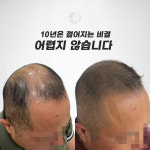 생명나무두피프렌즈 | 두피움SMP