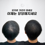 생명나무두피프렌즈 | 두피움SMP
