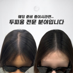 생명나무두피프렌즈 | 두피움SMP